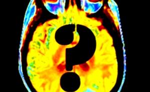 15年来大脑研究或付诸东流？ - 内蒙古心理网