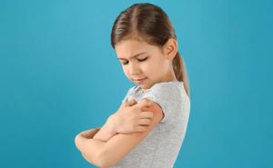 荨麻疹是一种孤单